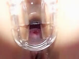 Kinky pregnant babe pussy gaped with speculum in close-up